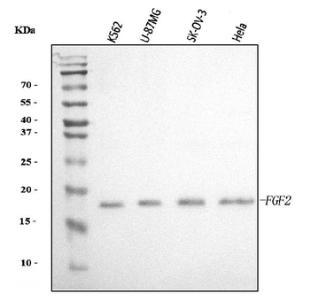 Anti-FGF2 Antibody