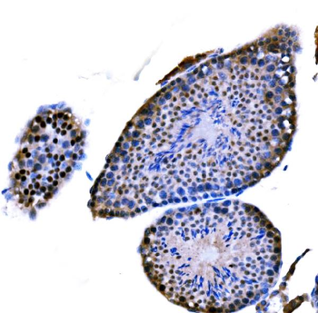 Anti-DMC1 Antibody