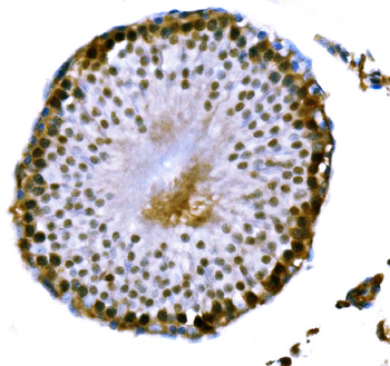 Anti-DMC1 Antibody