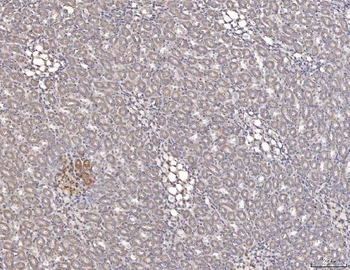 Anti-Cathepsin L/MEP/Ctsl Antibody