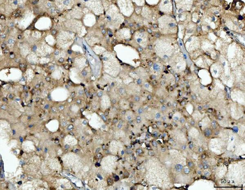 Anti-Cathepsin B/CTSB Antibody
