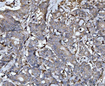 Anti-Cathepsin B/CTSB Antibody
