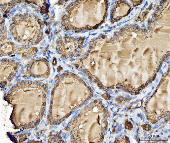 Anti-Cathepsin B/CTSB Antibody