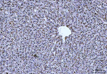 Anti-Cathepsin B/CTSB Antibody