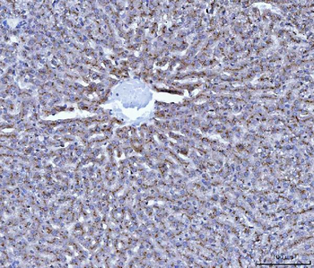 Anti-Cathepsin B/CTSB Antibody