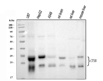 Anti-Cathepsin B/CTSB Antibody