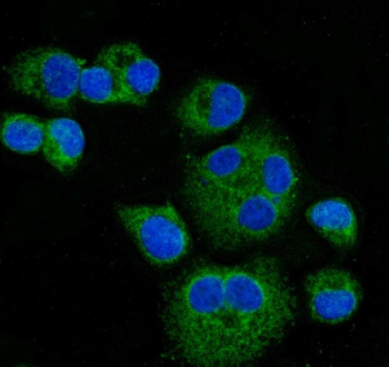 Anti-CPT1A Antibody