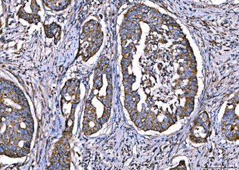 Anti-CPT1A Antibody