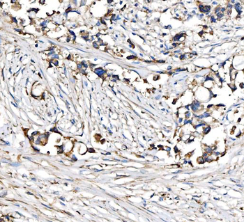 Anti-CPT1A Antibody