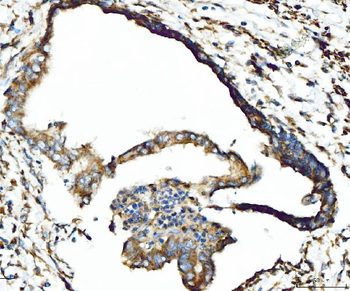 Anti-CPT1A Antibody