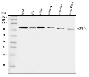 Anti-CPT1A Antibody