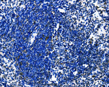 Anti-Dectin-1/Clec7a Antibody