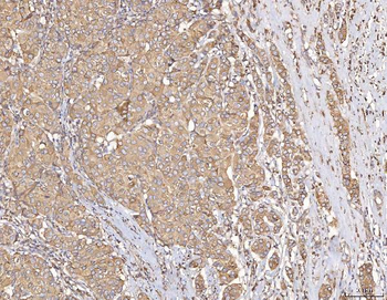 Anti-Calmegin/CLGN Antibody