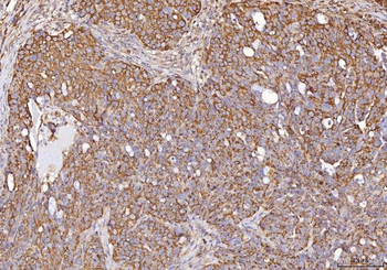 Anti-Calmegin/CLGN Antibody