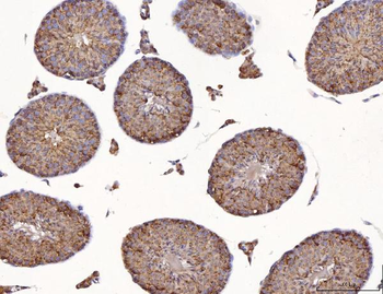 Anti-Calmegin/CLGN Antibody