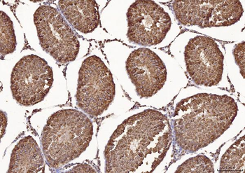 Anti-Calmegin/CLGN Antibody