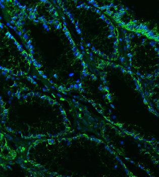 Anti-Claudin18/CLDN18 Antibody