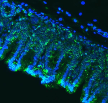 Anti-Claudin18/CLDN18 Antibody