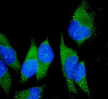 Anti-Claudin18/CLDN18 Antibody