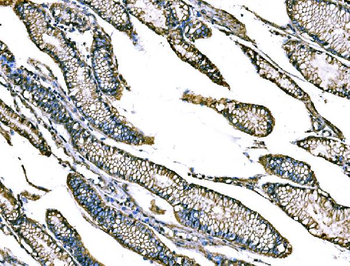 Anti-Claudin18/CLDN18 Antibody