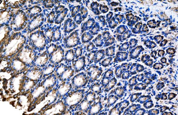 Anti-Claudin18/CLDN18 Antibody