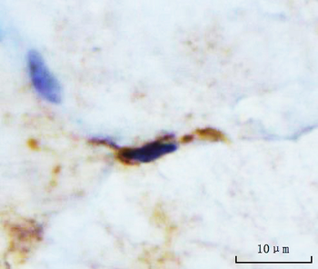 Anti-M Cadherin/CDH15 Antibody