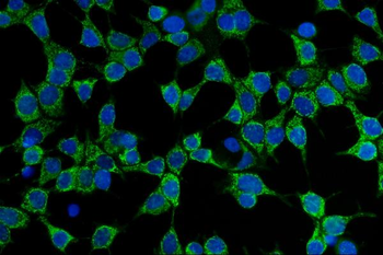 Anti-CD86 Antibody