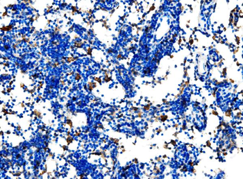 Anti-Cd27 Antibody