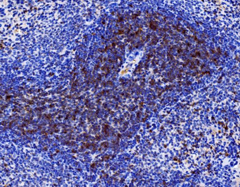 Anti-Cd27 Antibody