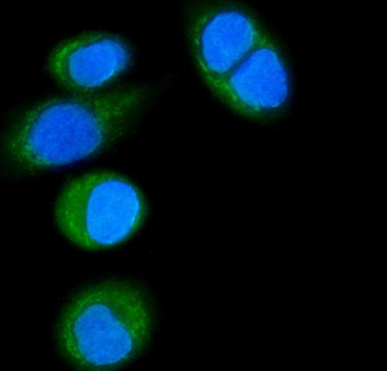 Anti-CD14 Antibody