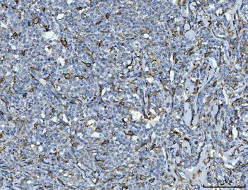 Anti-CD14 Antibody