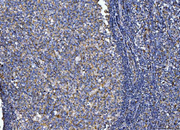 Anti-CD14 Antibody