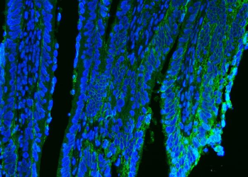 Anti-CD9 Antibody