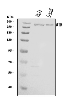 ATR Rabbit Polyclonal Antibody