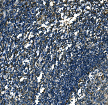 Anti-ATP6V1A Antibody