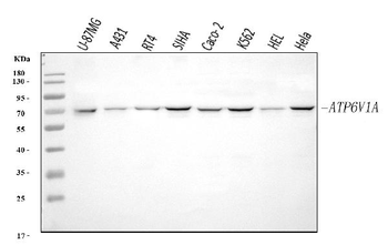 Anti-ATP6V1A Antibody