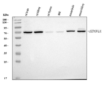 Anti-ATP6V1A Antibody