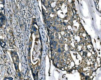 Anti-ATP6V1A Antibody