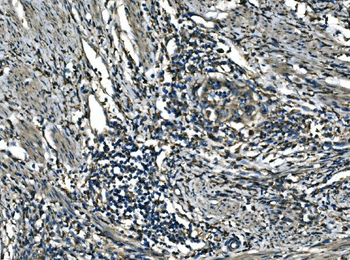 Anti-ATP6V1A Antibody