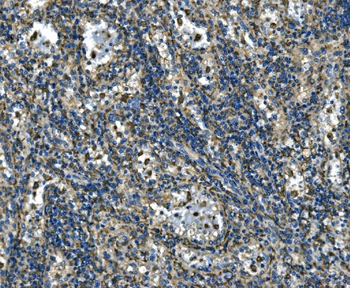 Anti-ATP6V1A Antibody