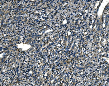 Anti-ATP6V1A Antibody