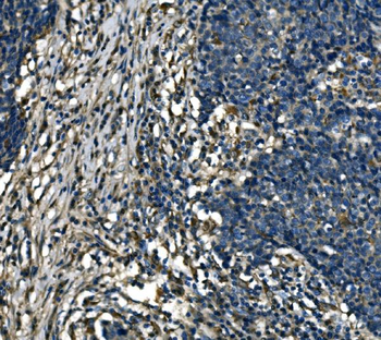 Anti-ATP6V1A Antibody