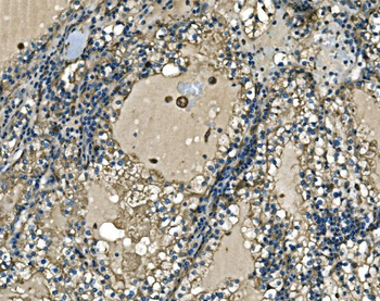 Anti-ATP6V1A Antibody
