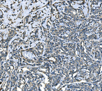 Anti-SPG3A/ATL1 Antibody
