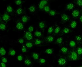 Anti-AKT1,2,3 Antibody