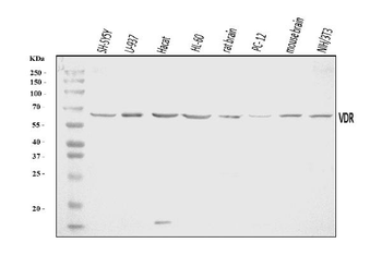Anti-Vitamin D Receptor/VDR Antibody