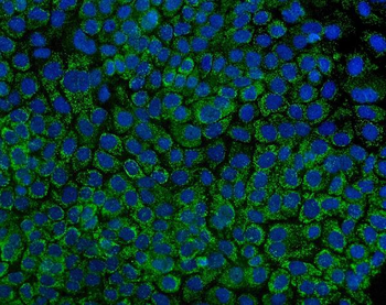Anti-Tryptophan Hydroxylase/TPH1 Antibody