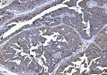 Anti-Tryptophan Hydroxylase/TPH1 Antibody
