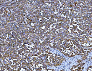 Anti-Tryptophan Hydroxylase/TPH1 Antibody