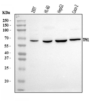 Anti-Tryptophan Hydroxylase/TPH1 Antibody